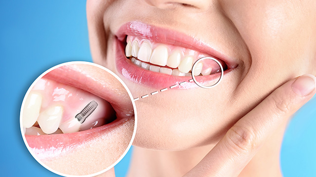 Henry Young, D.D.S. | Implant Dentistry, TMJ Disorders and Cosmetic Dentistry